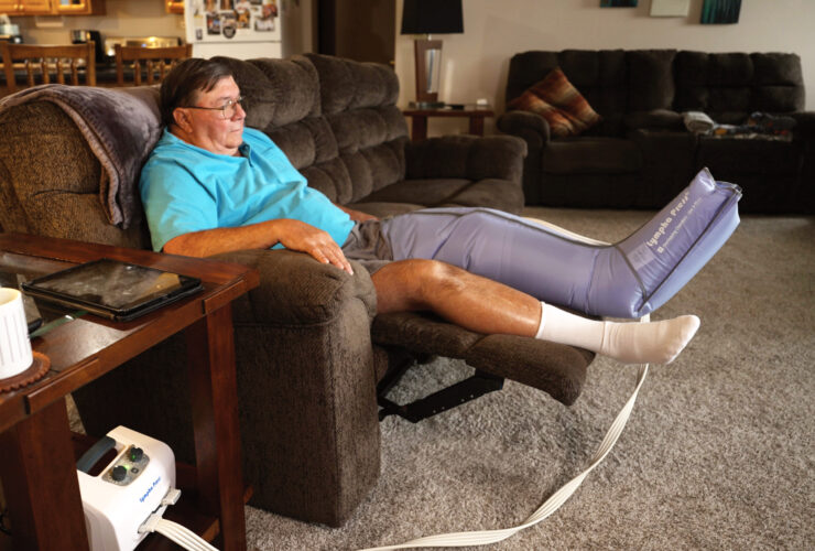 Surgery relieves chronic leg, arm swelling